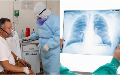 COVID-19: EsSalud advierte fibrosis pulmonar en pacientes que salieron de UCI