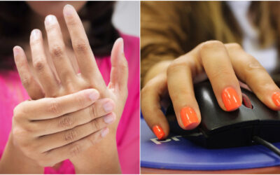 EsSalud advierte aumento de casos del síndrome del túnel del carpo