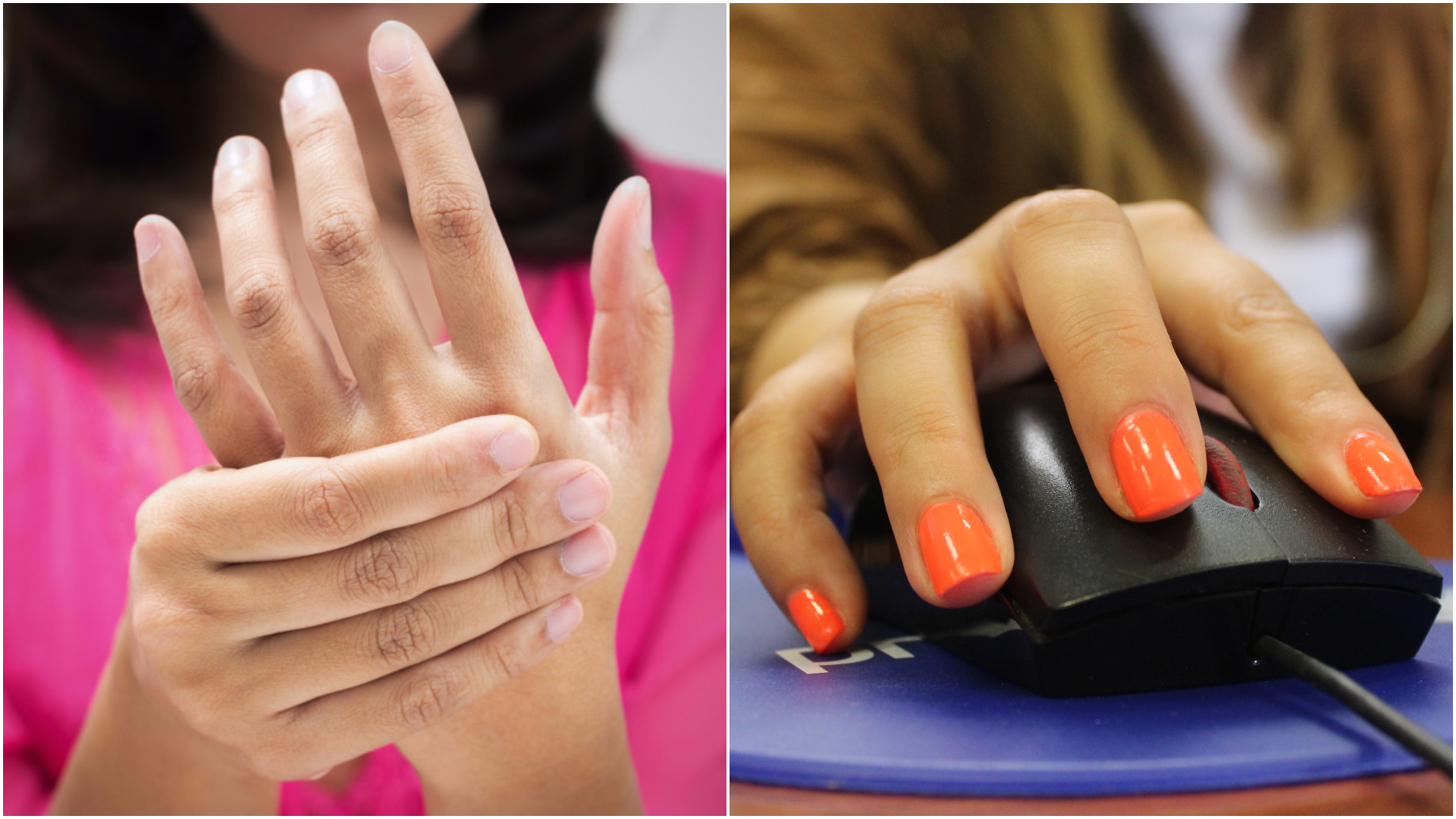 FotoJesindrome-del-tunel-del-carpo