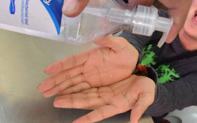 Uso excesivo de alcohol en gel puede afectar la piel de los niños