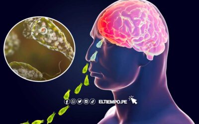 «Ameba comecerebros» en Perú: ¿Qué es la Naegleria fowleri, síntomas y cómo se contagia?