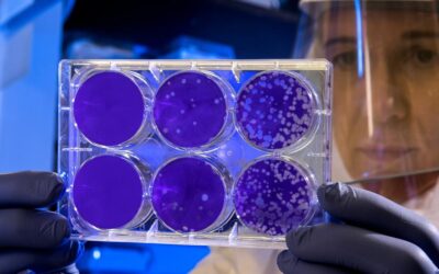 Células de cáncer serían capaces de hibernar «como los osos» para sobrevivir a quimioterapia, según estudio