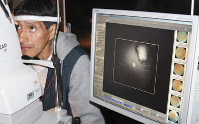 El 80% de casos de ceguera pudieron haberse prevenido