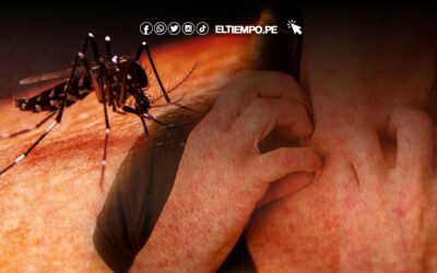 ¿Cómo calmar la comezón por dengue? Esto debes hacer para aliviar el «rash»
