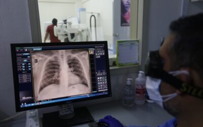 ¿Cómo saber si el COVID-19 afectó mis pulmones?