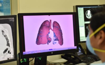 COVID-19: Adolescentes llegan a UCI con gran daño pulmonar