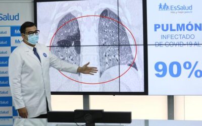 En solo cuatro días el COVID-19 puede dañar el pulmón, advierte EsSalud