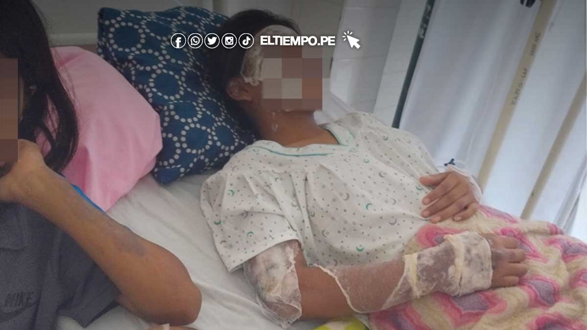 estudiantes-con-quemaduras