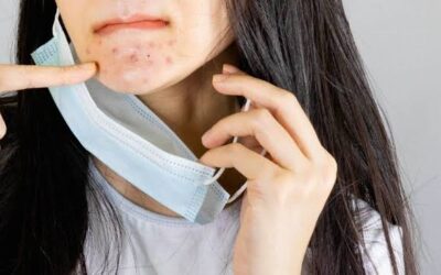 Cómo lidiar con el «maskne», el acné por el uso de la mascarilla