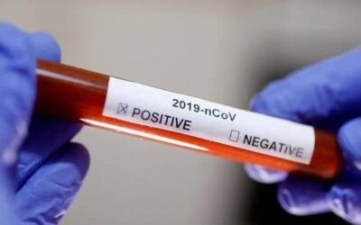 Conoce la diferencia entre una prueba rápida y una prueba molecular