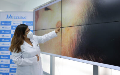 ¡Atención! Los lunares y las señales de alarma