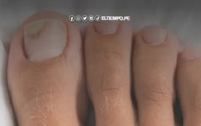 Precio de niogermox en Inkafarma y Mifarma: ¿cómo funciona el medicamento?