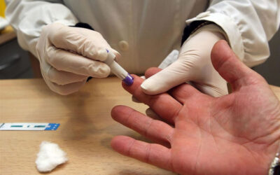 Sale al mercado la primera prueba que usa saliva para detectar el VIH en casa