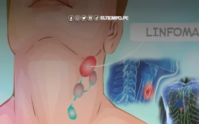 ¿Qué es el cáncer linfático? Enfermedad que padecía el ingeniero bailarín