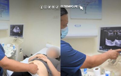 Casos de tumores de ovario en niñas y adolescentes aumenta en 20 %