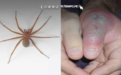 Invierno aumenta riesgo de mordeduras de araña casera