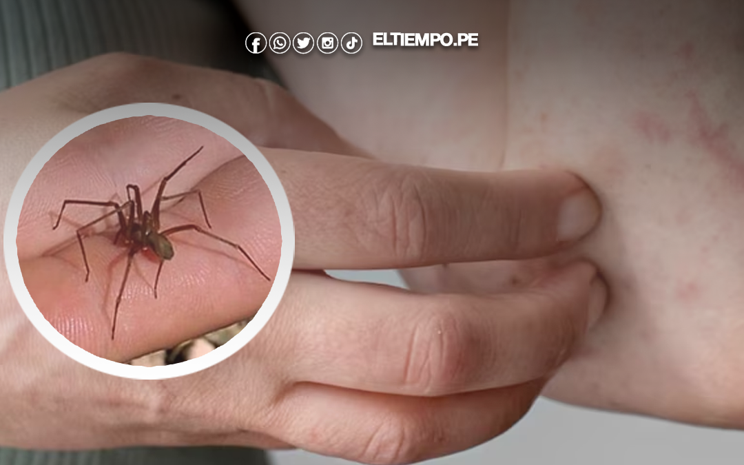 Araña casera cobra la vida de un niño en Ucayali