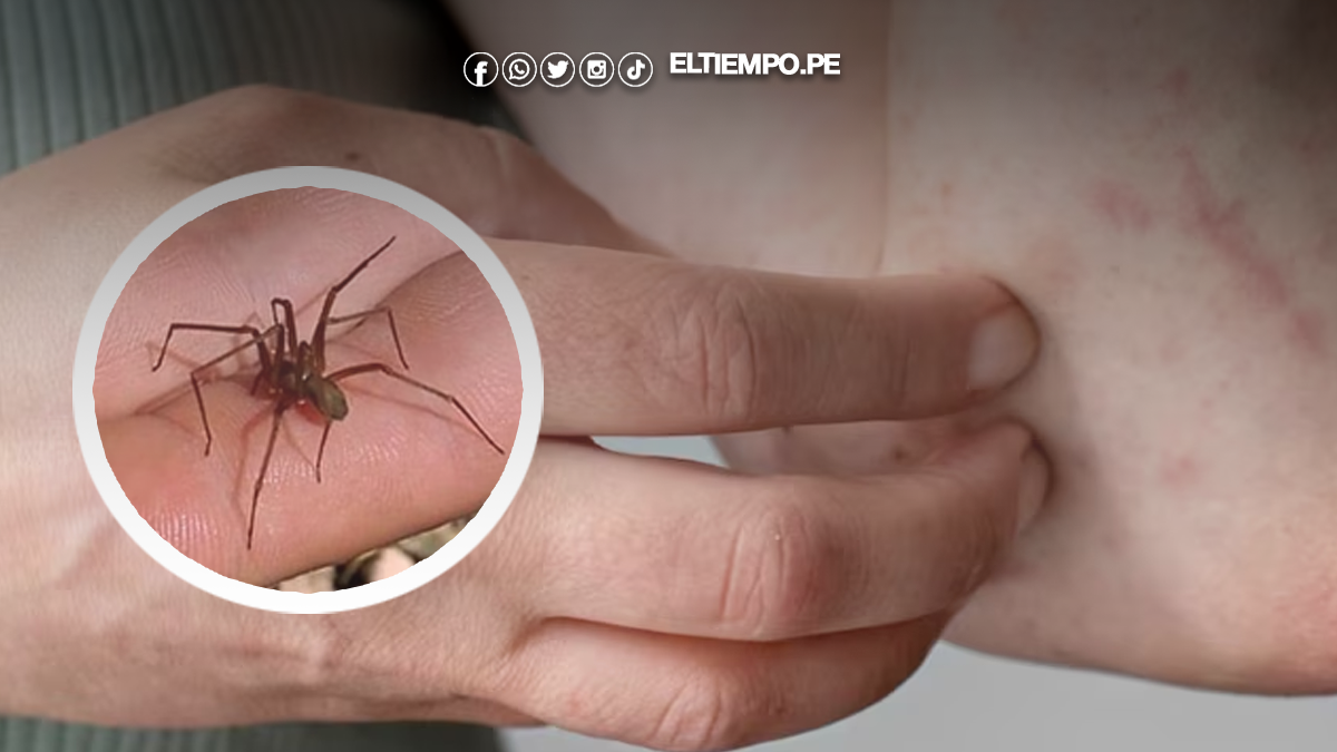 Araña casera cobra la vida de un niño en Ucayali Araña casera cobra la vida de un niño en Ucayali