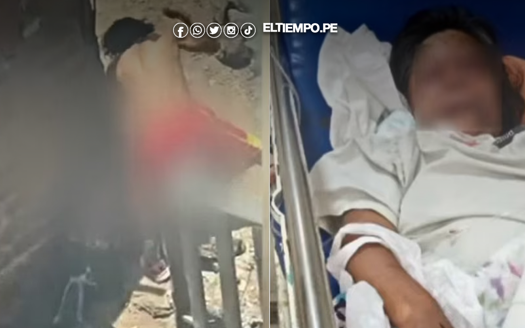 Lima: sujeto golpea brutalmente a su madre adulta mayor en Comas